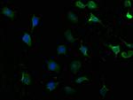 YARS Antibody in Immunocytochemistry (ICC/IF)