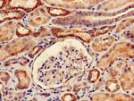 YARS Antibody in Immunohistochemistry (Paraffin) (IHC (P))