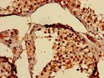 YARS Antibody in Immunohistochemistry (Paraffin) (IHC (P))