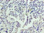 Cyclin D3 Antibody in Immunohistochemistry (Paraffin) (IHC (P))