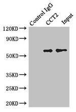 TCP-1 beta Antibody in Western Blot (WB)