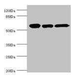 TCP-1 beta Antibody in Western Blot (WB)