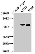 TCP-1 epsilon Antibody in Western Blot (WB)