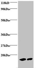 Hemoglobin Antibody in Western Blot (WB)