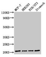 CD3g Antibody in Western Blot (WB)