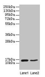 CD59 Antibody in Western Blot (WB)