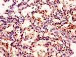 CD96 Antibody in Immunohistochemistry (Paraffin) (IHC (P))