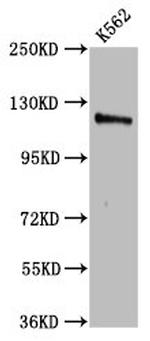 CENPJ Antibody in Western Blot (WB)