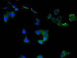 ChAT Antibody in Immunocytochemistry (ICC/IF)