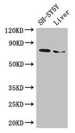 ChAT Antibody in Western Blot (WB)