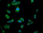 CHKA Antibody in Immunocytochemistry (ICC/IF)