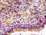 CHKA Antibody in Immunohistochemistry (Paraffin) (IHC (P))