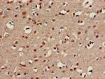 CHST1 Antibody in Immunohistochemistry (Paraffin) (IHC (P))