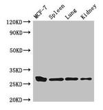 Mast Cell Chymase Antibody in Western Blot (WB)