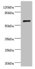 Collagen X Antibody in Western Blot (WB)