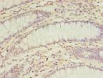 Carboxypeptidase A2 Antibody in Immunohistochemistry (Paraffin) (IHC (P))