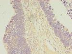 Carboxypeptidase A2 Antibody in Immunohistochemistry (Paraffin) (IHC (P))