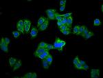 CPS1 Antibody in Immunocytochemistry (ICC/IF)