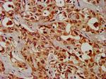 CPS1 Antibody in Immunohistochemistry (Paraffin) (IHC (P))