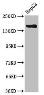 CPS1 Antibody in Western Blot (WB)