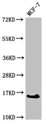 CRABP2 Antibody in Western Blot (WB)