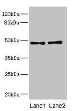 CRTAP Antibody in Western Blot (WB)