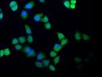 CAS Antibody in Immunocytochemistry (ICC/IF)