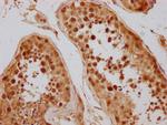 CAS Antibody in Immunohistochemistry (Paraffin) (IHC (P))