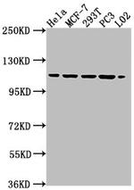 CAS Antibody in Western Blot (WB)