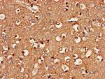 CSGALNACT2 Antibody in Immunohistochemistry (Paraffin) (IHC (P))