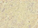 NG2 Antibody in Immunohistochemistry (Paraffin) (IHC (P))