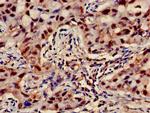 ATP5D Antibody in Immunohistochemistry (Paraffin) (IHC (P))