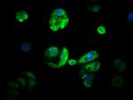 CYP21A2 Antibody in Immunocytochemistry (ICC/IF)