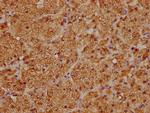 CYP21A2 Antibody in Immunohistochemistry (Paraffin) (IHC (P))