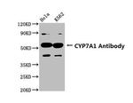 CYP7A1 Antibody in Western Blot (WB)