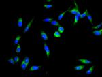 ZIPK Antibody in Immunocytochemistry (ICC/IF)