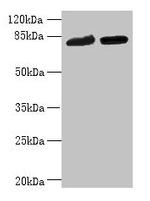 DDHD2 Antibody in Western Blot (WB)