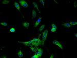 DDX6 Antibody in Immunocytochemistry (ICC/IF)