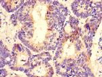 DDX6 Antibody in Immunohistochemistry (Paraffin) (IHC (P))