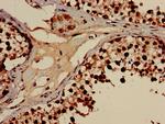 DHRS12 Antibody in Immunohistochemistry (Paraffin) (IHC (P))