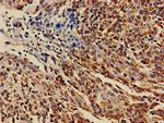 DHRS12 Antibody in Immunohistochemistry (Paraffin) (IHC (P))