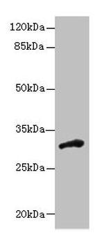 DHRS12 Antibody in Western Blot (WB)