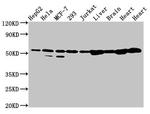 DLD Antibody in Western Blot (WB)