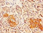 DLK1 Antibody in Immunohistochemistry (Paraffin) (IHC (P))