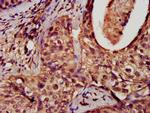 DNM1L Antibody in Immunohistochemistry (Paraffin) (IHC (P))