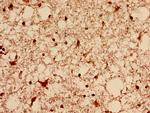 DNM1L Antibody in Immunohistochemistry (Paraffin) (IHC (P))