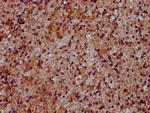 DYM Antibody in Immunohistochemistry (Paraffin) (IHC (P))