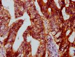 DYM Antibody in Immunohistochemistry (Paraffin) (IHC (P))