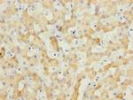 ECHS1 Antibody in Immunohistochemistry (Paraffin) (IHC (P))