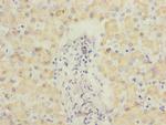 ECHS1 Antibody in Immunohistochemistry (Paraffin) (IHC (P))